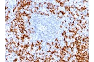 Immunohistochemistry (IHC) image for anti-Matrix Metallopeptidase 9 (Gelatinase B, 92kDa Gelatinase, 92kDa Type IV Collagenase) (MMP9) (AA 603-614) antibody (ABIN5707982)