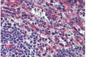 Human Spleen: Formalin-Fixed, Paraffin-Embedded (FFPE) (PLIN3 antibody  (AA 1-435))