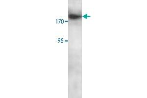 Western blot analysis of Jurkat cell lysate with RBBP6 polyclonal antibody  at 1 : 250 dilution.