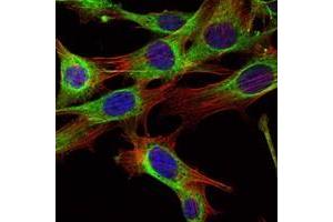 Immunofluorescence analysis of NIH/3T3 cells using ABL2 antibody (green). (ABL2 antibody)