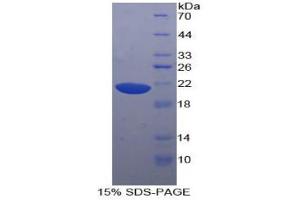 SDS-PAGE analysis of Human Hornerin Protein. (HRNR Protein)