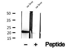 Western blot analysis of extracts of rat liver tissue, using CNPY2,MSAP antibody. (CNPY2/MSAP antibody  (C-Term))