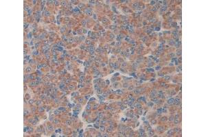 Used in DAB staining on fromalin fixed paraffin- embedded Kidney tissue (MTA1 antibody  (AA 6-218))