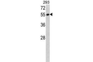 Western blot analysis of SERPINF1 Antibody (N-term) in 293 cell line lysates (35ug/lane). (PEDF antibody  (N-Term))