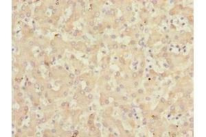 Immunohistochemistry of paraffin-embedded human liver tissue using ABIN7157720 at dilution of 1:100 (KLF15 antibody  (AA 1-260))