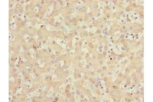 Immunohistochemistry of paraffin-embedded human liver tissue using ABIN7157720 at dilution of 1:100 (KLF15 antibody  (AA 1-260))