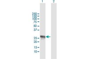 Western Blot analysis of IFIH1 expression in transfected 293T cell line by IFIH1 MaxPab polyclonal antibody. (IFIH1 antibody  (AA 1-221))