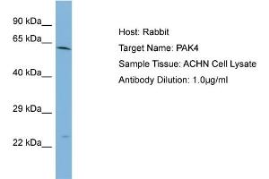 Host: Rabbit Target Name: PAK4 Sample Type: ACHN Whole cell lysates Antibody Dilution: 1. (PAK4 antibody  (Middle Region))