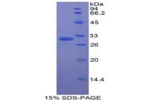 SDS-PAGE (SDS) image for Karyopherin alpha 2 (RAG Cohort 1, Importin alpha 1) (KPNA2) (AA 157-412) protein (His tag) (ABIN1877241) (KPNA2 Protein (AA 157-412) (His tag))