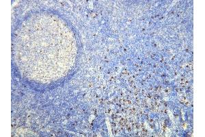 Immunohistochemistry (IHC) image for anti-lambda Light Chain (Lambda-IgLC) (AA 50-68), (N-Term) antibody (ABIN870374) (Lambda-IgLC antibody  (N-Term))