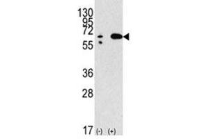 Western blot analysis of Beclin in 293 lysate transiently transfected with the BECN1 gene (2ug/lane).