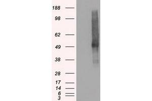 HEK293T cells were transfected with the pCMV6-ENTRY control (Left lane) or pCMV6-ENTRY SLC18A2 (Right lane) cDNA for 48 hrs and lysed. (SLC18A2 antibody)