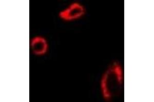 Immunofluorescent analysis of UROD staining in U2OS cells. (UROD antibody)