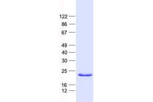 Validation with Western Blot (BIK Protein (His tag))