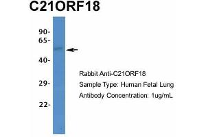 Host:  Rabbit  Target Name:  C21ORF18  Sample Type:  Human Fetal Lung  Antibody Dilution:  1.