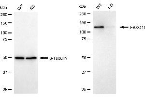 Western blotting analysis using FBXO11 antibody (ABIN7798553).