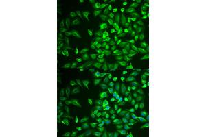 Immunofluorescence analysis of U2OS cells using LRAT antibody (ABIN5974000). (LRAT antibody)