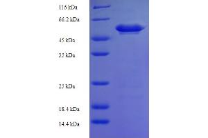 SDS-PAGE (SDS) image for Mitogen-Activated Protein Kinase Kinase 3 (MAP2K3) (AA 1-347), (full length) protein (His-SUMO Tag) (ABIN5709897)
