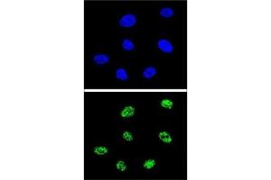 Confocal immunofluorescent analysis of p73 antibody with 293 cells followed by Alexa Fluor 488-conjugated goat anti-rabbit lgG (green). (Tumor Protein p73 antibody  (AA 288-317))
