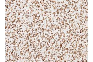 IHC-P Image Immunohistochemical analysis of paraffin-embedded TOV-21G xenograft, using ORC6L, antibody at 1:500 dilution.