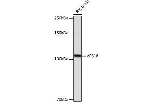 Western blot analysis of extracts of Rat brain, using VPS18 Rabbit mAb (ABIN7271274) at 1:1000 dilution. (VPS18 antibody)