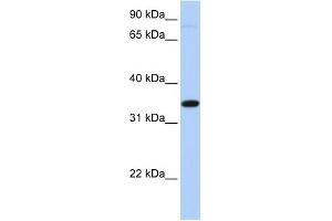 WB Suggested Anti-SLC44A3 Antibody Titration:  0. (SLC44A3 antibody  (Middle Region))