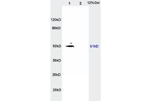 L1 rat kidney lysates, L2 rat brain lysates probed with Anti- SLC16A3/MCT4 Polyclonal Antibody, Unconjugated  at 1:200 in 4˚C. (SLC16A3 antibody  (AA 401-465))