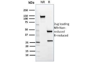 SDS-PAGE Analysis Purified SREBP2 Mouse Monoclonal Antibody (SREBP2/1579). (SREBF2 antibody)