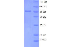 SDS-PAGE (SDS) image for 50S Ribosomal Protein L6 (AA 2-175), (partial) protein (GST tag) (ABIN1095445)