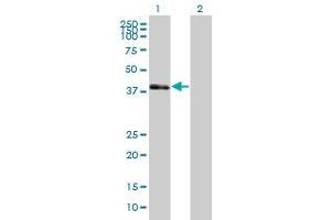 Lane 1: POU3F4 transfected lysate ( 39. (POU3F4 293T Cell Transient Overexpression Lysate(Denatured))