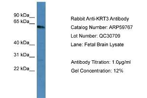 WB Suggested Anti-KRT3  Antibody Titration: 0.