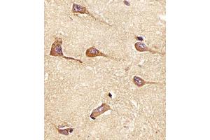 (ABIN6242187 and ABIN6577955) staining PH in Human brain tissue sections by Immunohistochemistry (IHC-P - paraformaldehyde-fixed, paraffin-embedded sections). (Amphiphysin antibody  (AA 336-370))