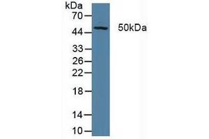 Detection of XPG in Porcine Liver Tissue using Polyclonal Antibody to Xeroderma Pigmentosum, Complementation Group G (XPG) (ERCC5 antibody  (AA 778-986))