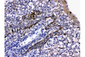 LFA3 was detected in paraffin-embedded sections of human tonsil tissues using rabbit anti- LFA3 Antigen Affinity purified polyclonal antibody (Catalog # ) at 1 µg/mL. (CD58 antibody  (AA 29-215))