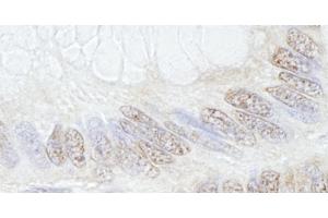Immunohistochemistry (IHC) image for anti-Tripartite Motif Containing 33 (TRIM33) (C-Term) antibody (ABIN7448843) (TRIM33 antibody  (C-Term))