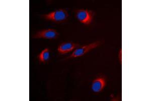 Immunofluorescent analysis of GPR18 staining in H9C2 cells. (GPR18 antibody  (Center))