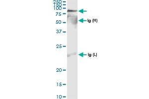 Immunoprecipitation of IDS transfected lysate using anti-IDS MaxPab rabbit polyclonal antibody and Protein A Magnetic Bead , and immunoblotted with IDS MaxPab rabbit polyclonal antibody (D01) . (IDS antibody  (AA 1-550))