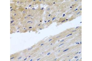 Immunohistochemistry of paraffin-embedded Rat heart using RAB24 Polyclonal Antibody at dilution of 1:100 (40x lens). (RAB24 antibody)