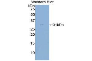 Western Blotting (WB) image for anti-Cytochrome P450, Family 21, Subfamily A, Polypeptide 2 (CYP21A2) (AA 37-264) antibody (ABIN3206433) (CYP21A2 antibody  (AA 37-264))