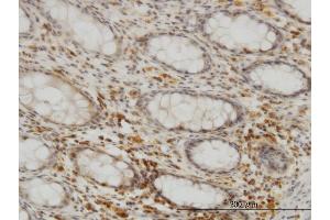 Immunoperoxidase of monoclonal antibody to SEPHS2 on formalin-fixed paraffin-embedded human colon. (SEPHS2 antibody  (AA 61-150))