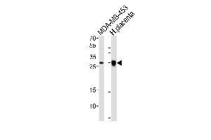 Western blot analysis of lysates from MDA-MB-453 cell line, human placenta tissue lysate (from left to right), using FOLR2 Antibody at 1:1000 at each lane.