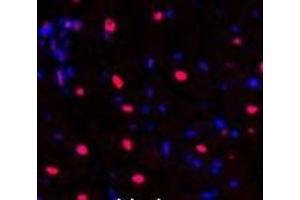 Immunofluorescence analysis of Rat heart tissue using NFκB-p105/p50 Polyclonal Antibody at dilution of 1:200. (NFKB1 antibody)