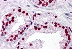 Human Prostate: Formalin-Fixed, Paraffin-Embedded (FFPE) (SMAD6 antibody  (AA 285-385))