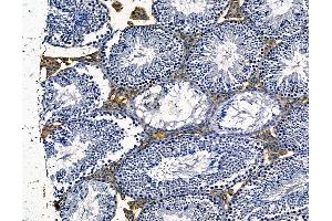 ABIN7094960 and ABIN7099016 at 1/100 staining mouse testis tissue by IHC-P.