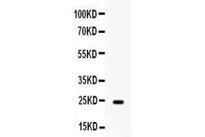 Western blot analysis of FGF1 expression in rat cardiac muscle extract ( Lane 1).
