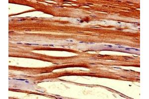 Immunohistochemistry of paraffin-embedded human skeletal muscle tissue using ABIN7172041 at dilution of 1:100 (TMX2 antibody  (AA 49-102))
