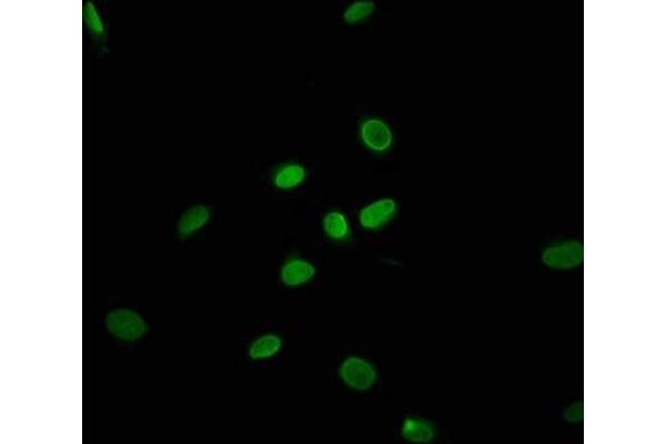 TRAPPC11 antibody  (AA 704-836)