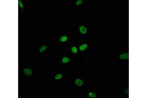 Immunofluorescence staining of U251 cells with ABIN7172353 at 1:100, counter-stained with DAPI.