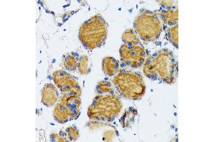 Immunohistochemistry of paraffin-embedded mouse thyroid using Thyroid Peroxidase Rabbit mAb (ABIN7270865) at dilution of 1:100 (40x lens). (TPO antibody)