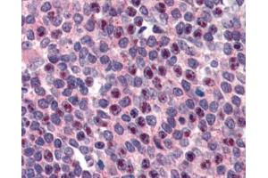 IHC testing of FFPE human spleen tissue with FANCG antibody at 3ug/ml. (FANCG antibody)
